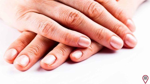 Mistakes we make when trying to stop biting our nails