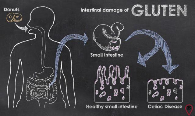 Conosci i 5 segni di intolleranza al glutine