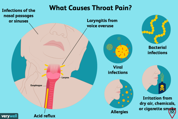 Infiammazione alla gola: capire la causa del dolore